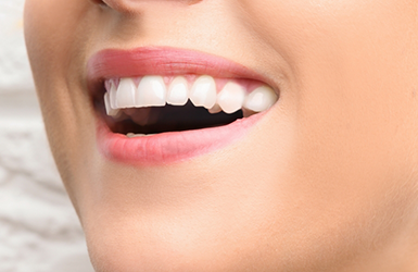 Close up of a smile with straight white teeth
