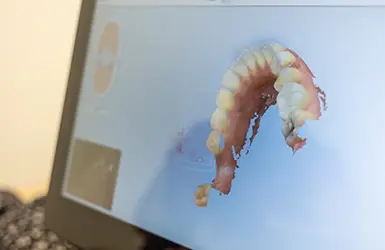 Young brunette woman smiling in the dental chair