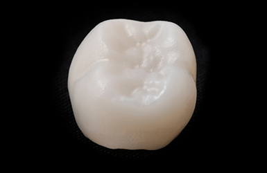 Tooth colored dental crown against a black background