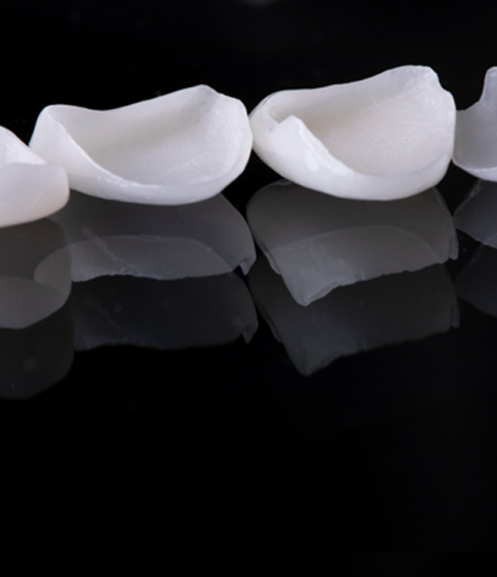 Multiple veneers in Grand Prairie sitting in a row on black reflective surface
