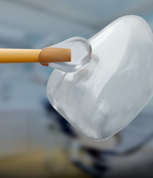 Applying clear substance to a dental veneer