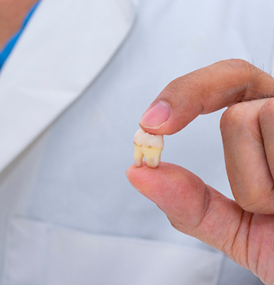 Person holding an extracted wisdom tooth in their hand